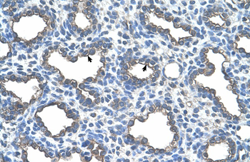 UBE2D2 Rabbit Polyclonal Antibody