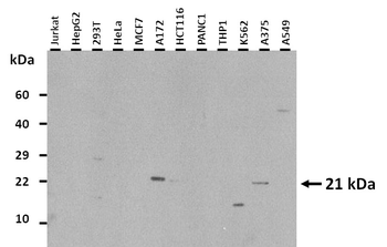 UBE2E1 Rabbit Polyclonal Antibody