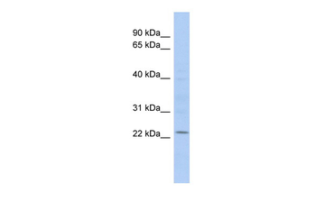 UBE2E1 Rabbit Polyclonal Antibody