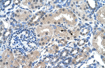 FKBP6 Rabbit Polyclonal Antibody