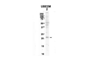 UBE2M Rabbit Polyclonal Antibody