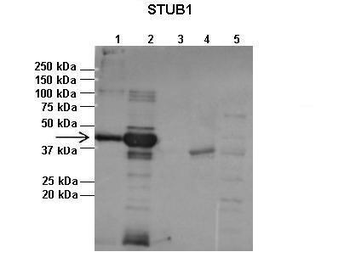 STUB1 Rabbit Polyclonal Antibody