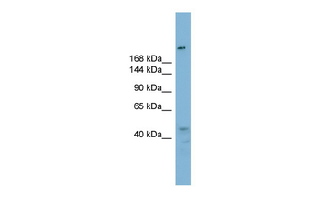 RBBP6 Rabbit Polyclonal Antibody