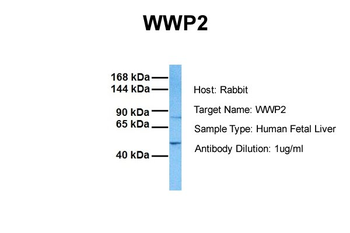 WWP2 Rabbit Polyclonal Antibody