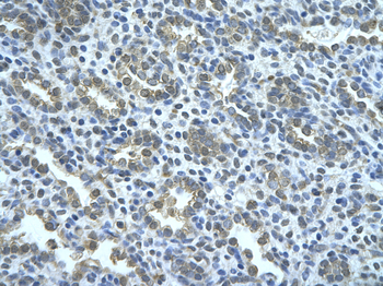 WWP2 Rabbit Polyclonal Antibody