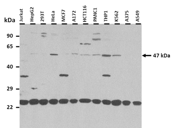 FBXL2 Rabbit Polyclonal Antibody