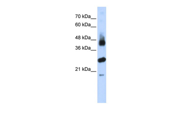 FBXL2 Rabbit Polyclonal Antibody