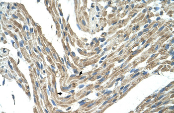 FBXL5 Rabbit Polyclonal Antibody