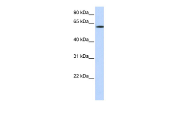 FBXO24 Rabbit Polyclonal Antibody