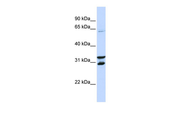 FBXO24 Rabbit Polyclonal Antibody