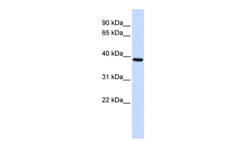 FBXO24 Rabbit Polyclonal Antibody