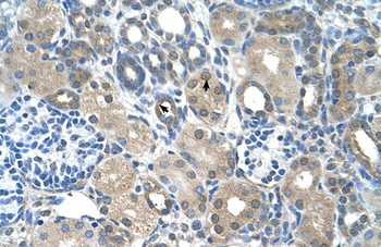 FBXO25 Rabbit Polyclonal Antibody