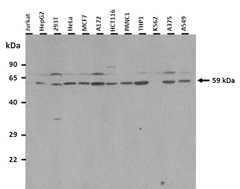 FBXO7 Rabbit Polyclonal Antibody