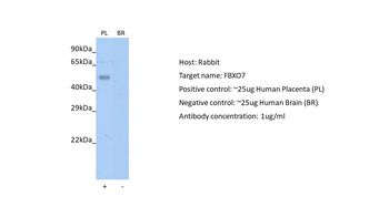FBXO7 Rabbit Polyclonal Antibody