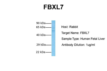FBXL7 Rabbit Polyclonal Antibody