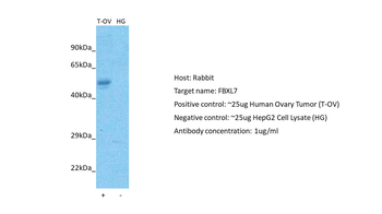 FBXL7 Rabbit Polyclonal Antibody
