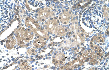 FBXL7 Rabbit Polyclonal Antibody