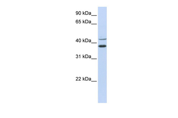 MKRN2 Rabbit Polyclonal Antibody