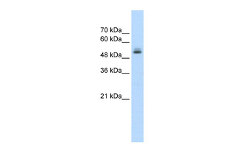 PRPF19 Rabbit Polyclonal Antibody