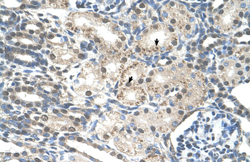 PRPF19 Rabbit Polyclonal Antibody