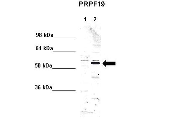 PRPF19 Rabbit Polyclonal Antibody