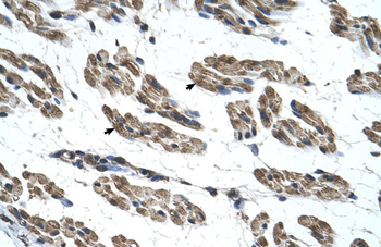 RNF40 Rabbit Polyclonal Antibody