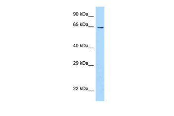 Ubox5 Rabbit Polyclonal Antibody