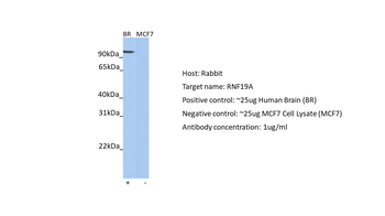 RNF19A Rabbit Polyclonal Antibody