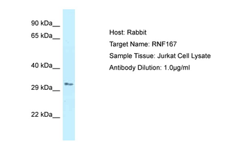 RNF167 Rabbit Polyclonal Antibody