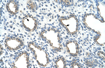 UBE2J1 Rabbit Polyclonal Antibody