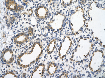 UBE2J1 Rabbit Polyclonal Antibody