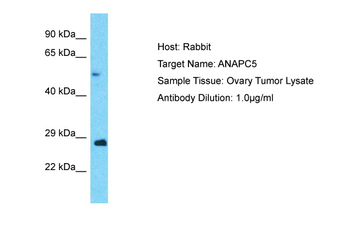 ANAPC5 Rabbit Polyclonal Antibody