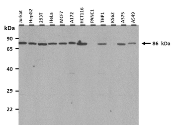 RNF43 Rabbit Polyclonal Antibody