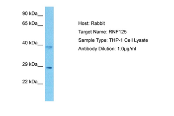 RNF125 Rabbit Polyclonal Antibody