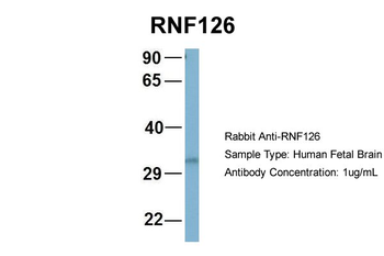 RNF126 Rabbit Polyclonal Antibody