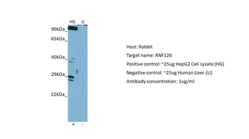 RNF126 Rabbit Polyclonal Antibody