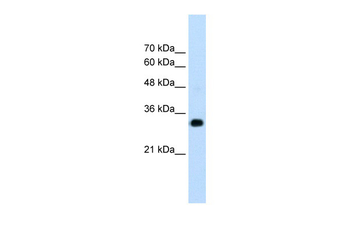 RNF121 Rabbit Polyclonal Antibody