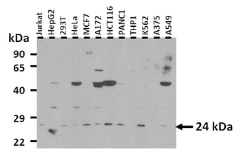 RNF186 Rabbit Polyclonal Antibody