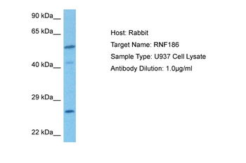 RNF186 Rabbit Polyclonal Antibody