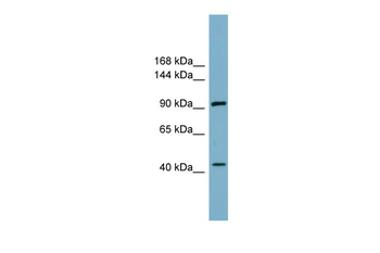 ITCH Rabbit Polyclonal Antibody