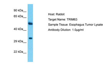 TRIM63 Rabbit Polyclonal Antibody