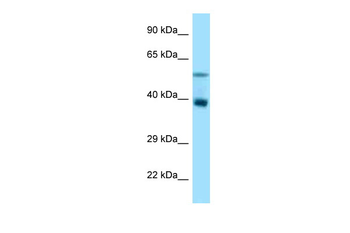 Trim7 Rabbit Polyclonal Antibody