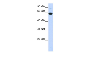FBXO24 Rabbit Polyclonal Antibody