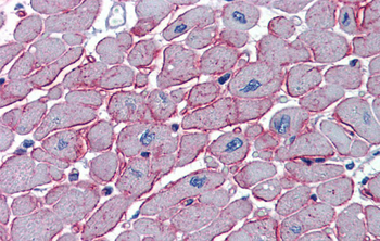 DCST1 Rabbit Polyclonal Antibody