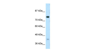 DCST1 Rabbit Polyclonal Antibody