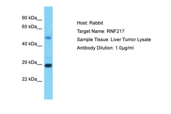 RNF217 Rabbit Polyclonal Antibody