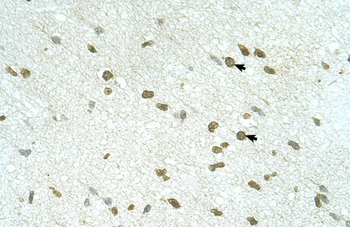 RNF168 Rabbit Polyclonal Antibody