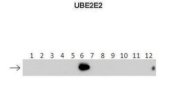 UBE2E2 Rabbit Polyclonal Antibody