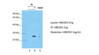 UBE2E2 Rabbit Polyclonal Antibody