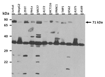 RNF207 Rabbit Polyclonal Antibody
